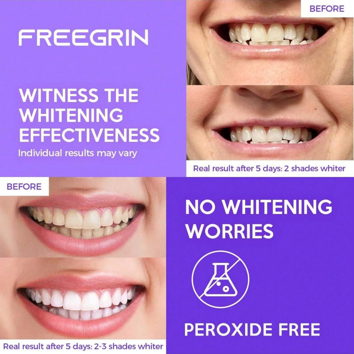Adesivi sbiancanti per denti d - Home Fragrance Gel recensione e prezzo